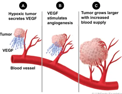 Figure 1.6.  Tumor cells promote the development of angiogenesis. 