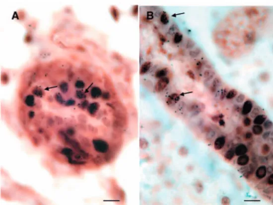Fig. 3. (A-E) Nuclei positive for 5BrdU/3HtdR alone (A,E) or 5BrdU alone (B-D). (F-J) 5BrdU/3HTdR-labeled cell nuclei