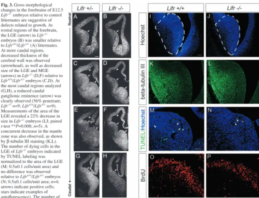 Fig. 3. Gross morphologicalchanges in the forebrains of E12.5