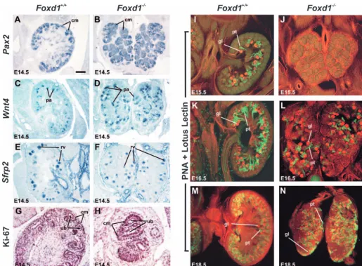 Fig. 5. Nephrogenesis is delayed and disorganized in the Foxd1 null. (A) Wild type displayed Pax2 expression in condensed mesenchyme (cm)around the UB tips