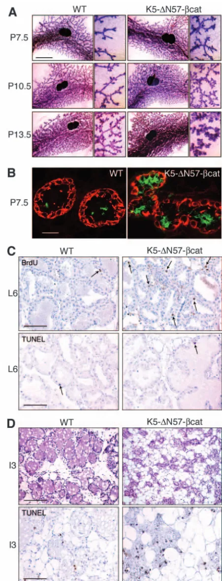 Fig. 2. Expression of ∆N57-β-catenin in basal mammary cellsinduces precocious development in pregnancy, persistent