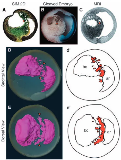 Fig. 12. Archenteron inﬂation by ﬂuid transfer from the blastocoel.(A-D) Cavities between the blastocoel and the archenteron werevisualized with SIM (sagittal section, A), in cleaved embryos (B),and with MRI (sagittal section of intact embryo, C)
