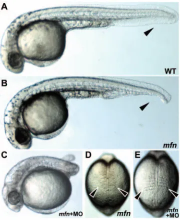 Fig. 5. Knockdown of Tsg function partially suppresses the chordinoventralization. (A) Uninjected  homozygote; arrowheads