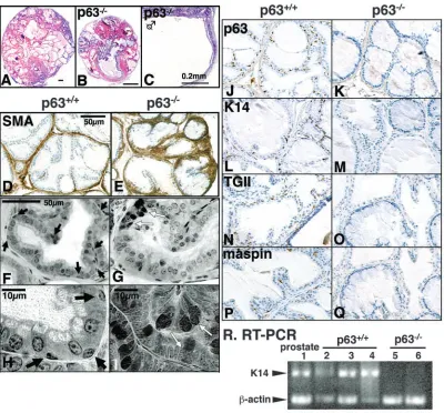 Fig. 2. p63(lanes 5 and 6). (coagulating gland + ventral prostate + dorsolateral prostate, lane 1) and three –/– prostate lacks basal cells