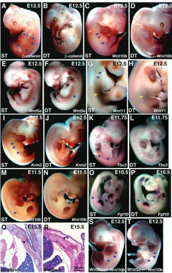 Fig. 6. Absence of localized expression oftransgenic littermates at E10.5 (O,P, arrows).(Q,R) Transverse hematoxylin and eosin-stained paraffin sections of E15.5 transgenic littermates (B,D,J,L)