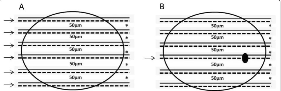 Figure 1 Schematic representation of lymph nodes sectioning protocol for immunohistochemistry (solid line) and molecular (dotted line)analyses