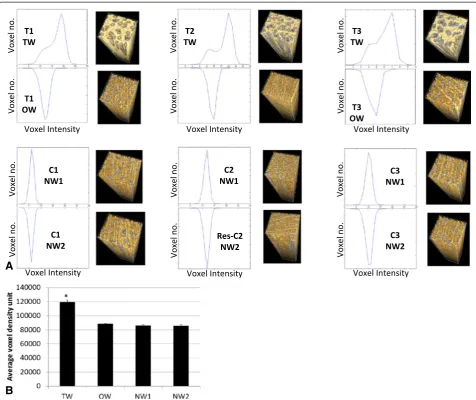 Figure 3 Voxel distribution. A Matlab histograms of voxel intensity distribution for each ROI, TW, OW and NW and 3D render of each ROI, unitsare not included as the number of voxels varied (histograms are to compare intensity distribution)