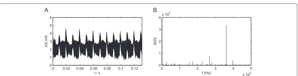 Figure 14 The frequency response of multiple notch filter for corona current. (A) Magnitude response