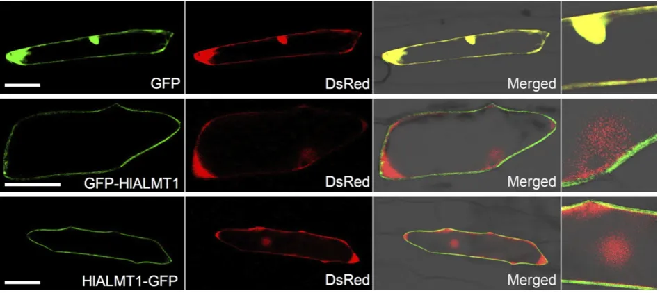 Figure 4. Subcellular localization of HlALMT1.Constructs expressing GFP alone (top panels) or fusions between HlALMT1 and green ﬂuorescent protein gene (GFP) at the N–terminus (middle panels) or theC–terminus (bottom panels) were introduced into onion epid