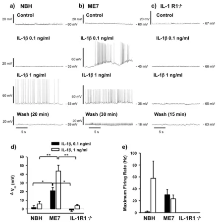 Fig. 4 Differential sensitivity of CA1 pyramidal cells to IL-1β inhippocampal slices from NBH and ME7 animals