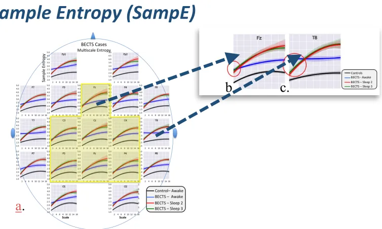 Figure 3. a. Multiscale curve with centrotemporal region highlighted; b. Multiscale 