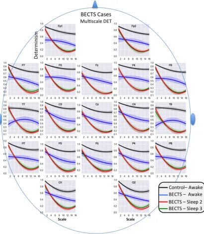 Figure 5. Multiscale DET curves for awake and asleep cases. 