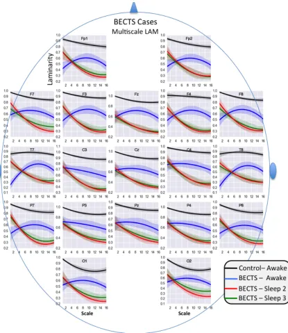 Figure 6. Multiscale LAM curves for awake and asleep cases. 