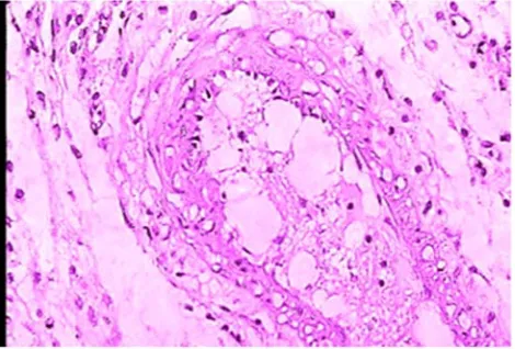 Figure 7 (a) : Representative histological appearance of rat colonic mucosa I-normal control (mucosal layer)