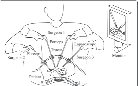 Figure 1 Conventional laparoscopic surgery.