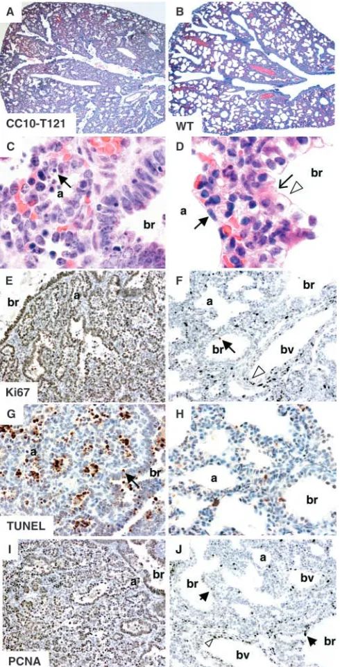 Fig. 5. Rb family deﬁciency results in lung epithelial abnormalities.(A-D) Morphological examination of transgenic (CC10-T121; A,C)and control wild-type (WT; B,D) lungs