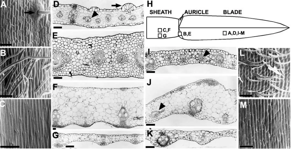 Fig. 2. Scanning electron and light micrographs illustrating epidermal and histological features of wild-type and mutant leaves