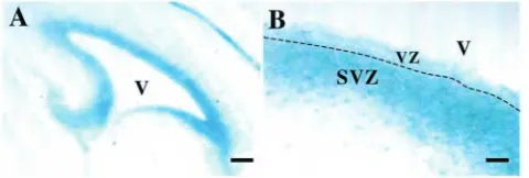 Fig. 1. Expression of tenascin C (TNC) in subventricular zone (SVZ)in A; 40 cells revealed by lacZ expression from the transgene in TNCheterozygous mice