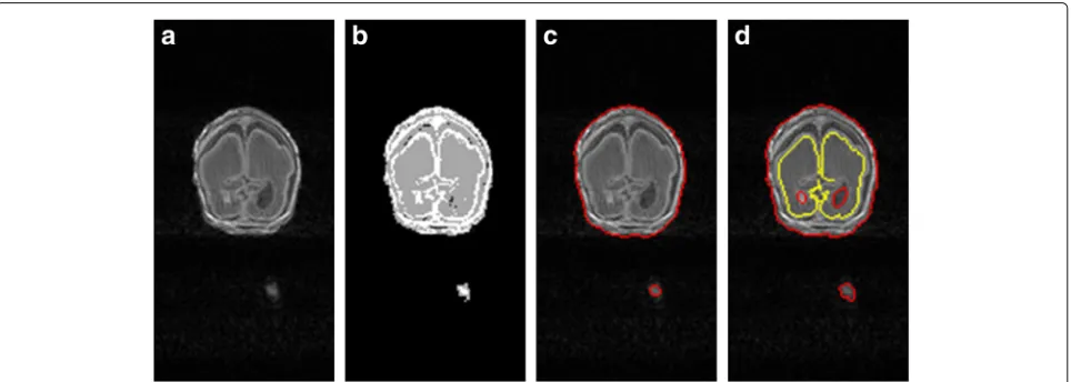 Fig. 9 Comparison with the work [31]: a original MR image, b result via [31], and c result based on our method