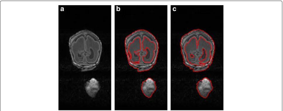 Fig. 11 Comparison with [31]: a the 84th MR image, b the result via [31], and c the result based on our method