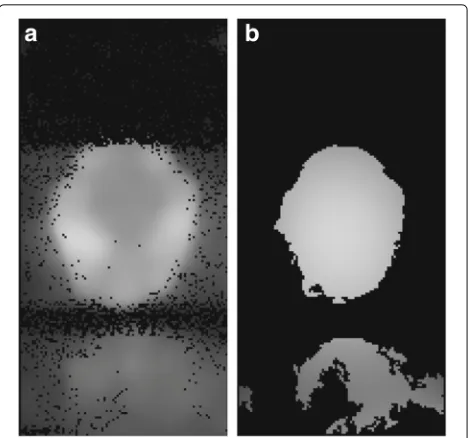 Fig. 2 Bias field estimation by a Li’s method [22]; b the proposedmethod in this paper