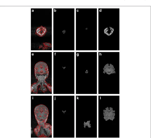 Fig. 6 Segmentation processes for the other frames:67th MR image, and a the 14th MR image, b–d segmented parts, e the 50th MR image, f–h segmented parts, i the j–l segmented parts
