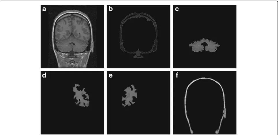 Fig. 8 Comparison of errors in different contours