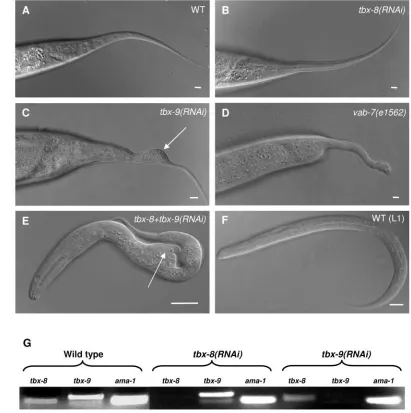 Fig. 2. RNA interference(RNAi) phenotypes of tbx-8
