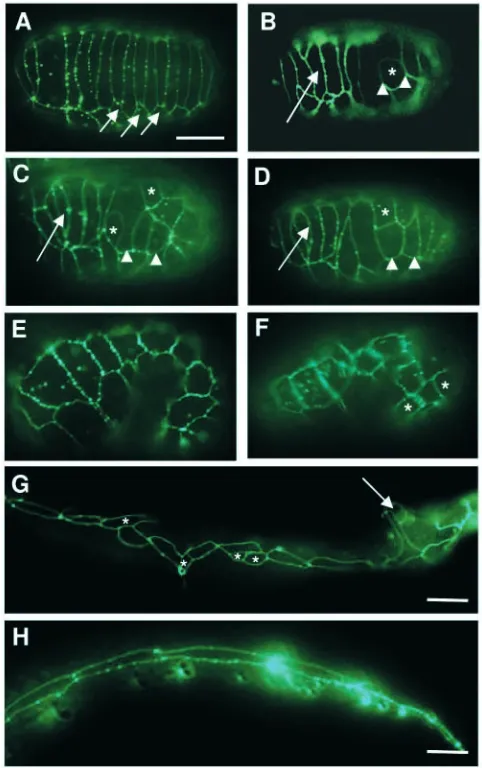 Fig. 3. Hypodermal defects in tbx-8/tbx-9(RNAi) animals. Thearrangement of hypodermal cells in embryos and L1 larvae has beenvisualised using the ajm-1::GFP reporter