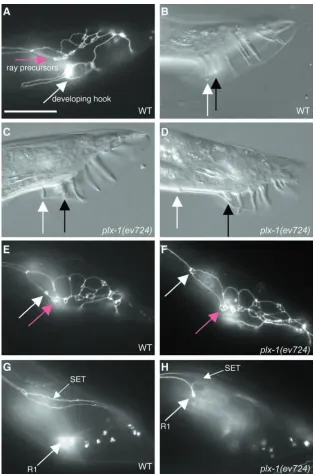 Fig. 2. Ray 1 cells and the adult ray 1 are displacedanteriorly in plx-1(ev724). The position of ray 1cells was determined by ﬂuorescence microscopyusing the ajm-1::GFP reporter in L3 males (Baird etal., 1991; Koppen et al., 2001)