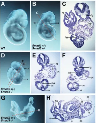 Fig. 3. Abnormalities in (B)embryos. Whole-mount views of E9.5 (A) wild-type(WT), (B) morphology