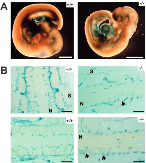 Fig. 6. (A) Wild-type control.(B) Neuronal ectopias (arrows)are present in E11.5 mutantembryos because of themigration of neuronal cellsthrough the pial basementmembrane into the surroundingmesenchymal layers (arrows).N, neuroectoderm