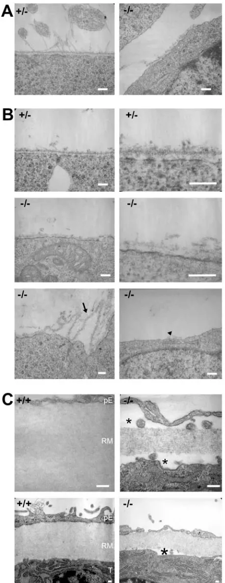 Fig. 8. Ultrastructural abnormalities in basement membranes ofcollagen IV-deﬁcient embryos