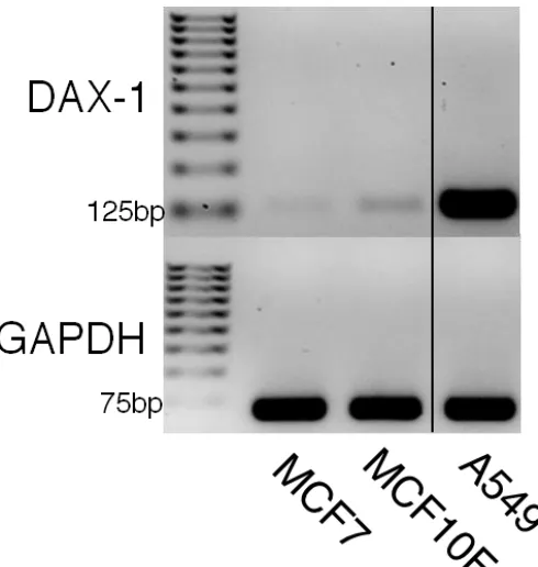 Figure 2-2 DAX-1 reverse transcriptase-PCR visualized by 2% agarose gel electrophoresis