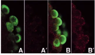 Fig. 5. torso-nos3galactosidase antibody. antibodies (red). All images show embryos at cycle 10