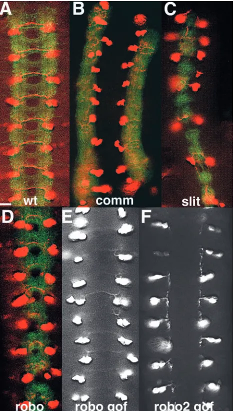 Fig. 2. Initial screen of midline axon guidance mutants did not reveala loss of SerT expression