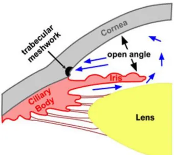Figure 4: Schematic diagram Primary Open Angle Glaucoma  Source: Stepwards, Open-angle Glaucoma 