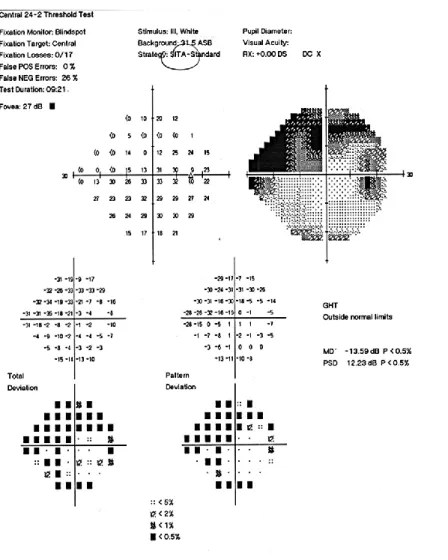 Figure 6: HVF 24-2 SITA Visual Field test results chart 