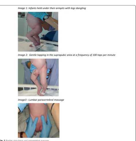 Fig. 2 Bladder stimulation and paravertebral massage