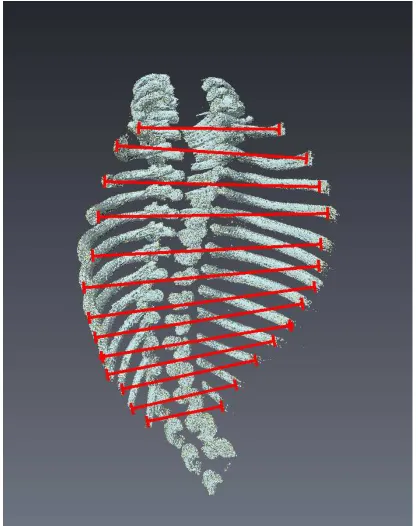 Figure 5. Procedural Schematic of Ribcage Width Measurement. Deformation in terms of width was defined as the distance across the entire width of the sample, from the centroid of the distal epiphysis of each developing ribs (Pictured: control) 