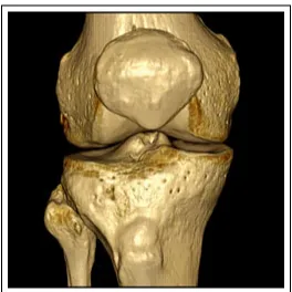 Figure 2.3: CT scan of a knee joint [20]