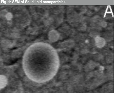 Fig. 1: SEM of Solid lipid nanoparticles