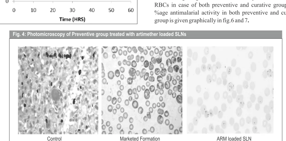 Fig. 4: Photomicroscopy of Preventive group treated with artimether loaded SLNs