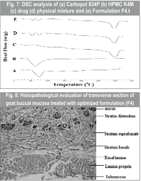 Fig. 7: DSC analysis of (a) Carbopol 934P (b) HPMC K4M (c) drug (d) physical mixture and (e) Formulation F4.t