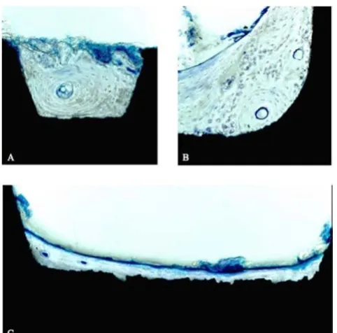 Figure 3human boneHistological evaluation of SLA®-surface performance in Histological evaluation of SLA®-surface performance in human bone