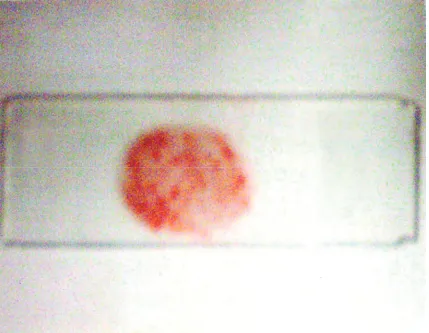 Figure 2. Determination of o/w type of emulsion i.e. dispersed oil globules appeared ‘red’ and continuous phase ‘col-ourless’