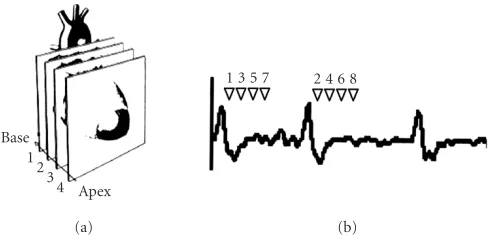 Figure 1: (a) Spatial and (b) temporal 3D data acquisition inFGRET sequence.