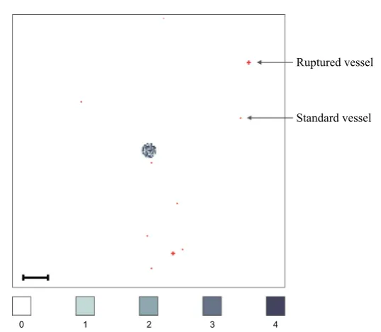 Fig. 7 Vessel distribution and initial condition of cancer cells. The plot shows (in red) ten randomly dis-tributed blood vessels on the primary grid, two of which are so-called ruptured vessels that consist of ﬁverather than one grid point
