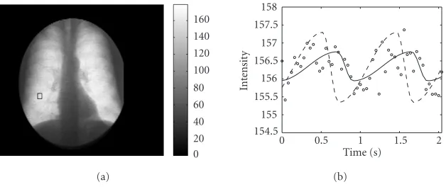 Figure 7: Using the cardiac systolic and diastolic phases to constrain the parameter extraction from an enhanced pulmonary perfusionparameter extraction process