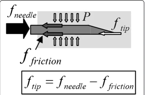 Figure 1 Force acting on the needle during the insertion.